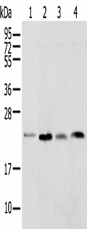 Western blot analysis of Rat lung tissue HT-29 cell Mouse adrenal gland tissue and K-562 cell  using SPCS2 Polyclonal Antibody at dilution of 1:450