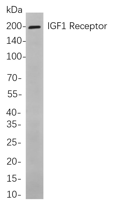 Recombinant IGF1 Receptor Monoclonal Antibody-searchlist-1