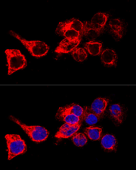 Confocal immunofluorescence analysis of HeLa cells using KRT17 Polyclonal Antibody at dilution of 1:200. Blue: DAPI for nuclear staining.