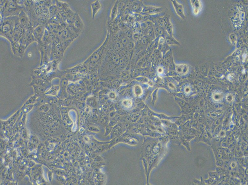 NCI-H441 Cell Complete Medium - 4