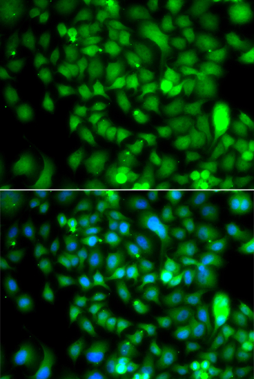 Immunofluorescence analysis of A549 cells using CSRP2BP Polyclonal Antibody Blue: DAPI for nuclear staining.