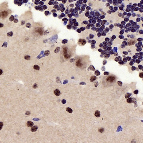 Immunohistochemistry analysis of paraffin-embedded Mouse brain  using P38 Polyclonal Antibody at dilution of 1:500.