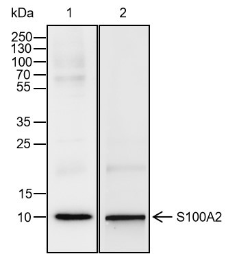 Recombinant S100A2 Monoclonal Antibody-searchlist-1