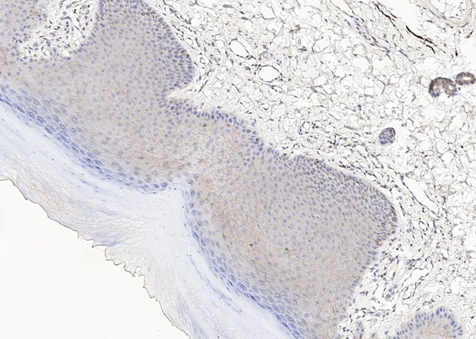 TROP2/TACSTD2 Monoclonal Antibody - small - 6