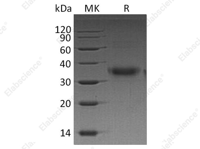 Recombinant Human FOLR1 Protein (His Tag) - 1