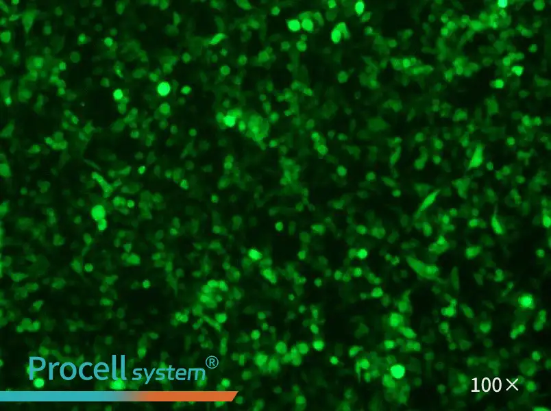 RM-1-GFP Cell Complete MediumRM-1-GFP Cell Complete Medium - 3