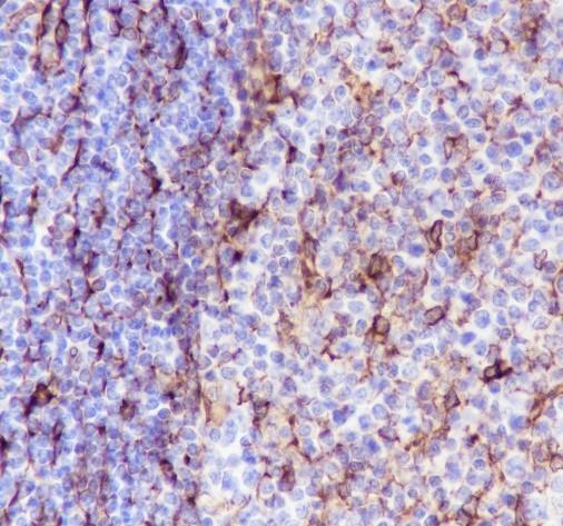 Recombinant STING Monoclonal Antibody - 2