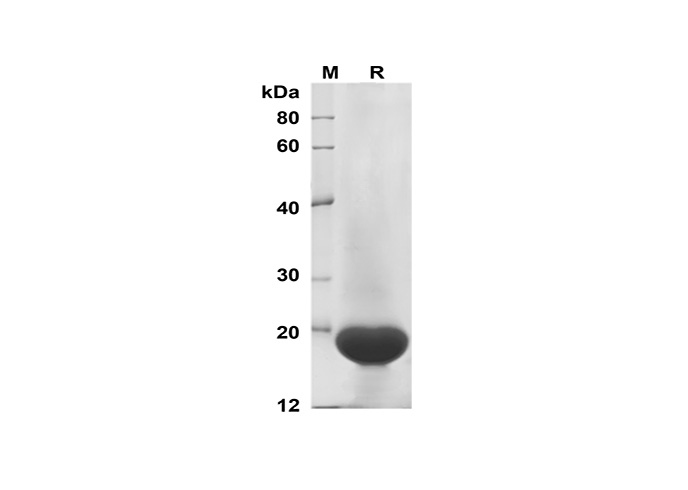 Recombinant Human IL-33 Protein(TRX Tag)-产品推荐-1