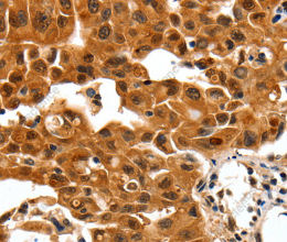 14-3-3 beta/alpha Polyclonal Antibody - 2
