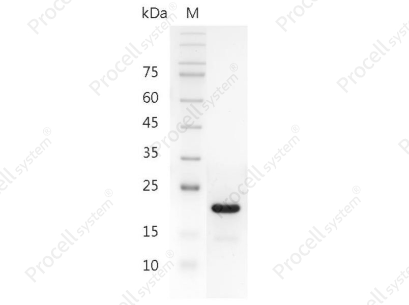 IL-11/AGIF, Human, Recombinant