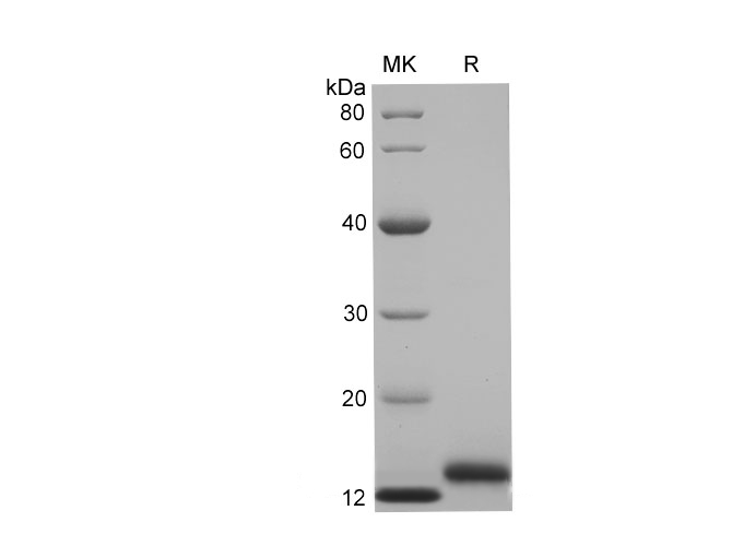 Recombinant Rat IL-4 Protein(Trx Tag)-产品推荐-1