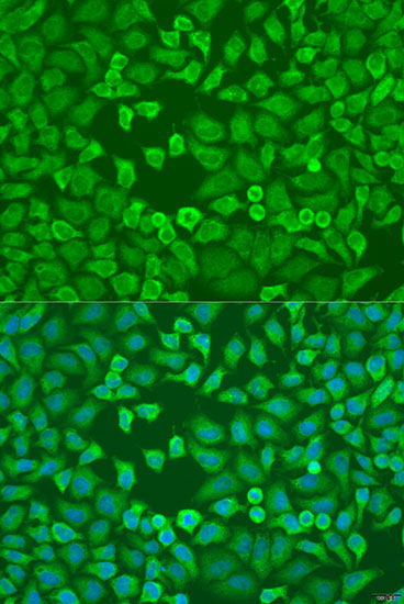Immunofluorescence analysis of U2OS cells using EIF3A Polyclonal Antibody at dilution of 1:100. Blue: DAPI for nuclear staining.