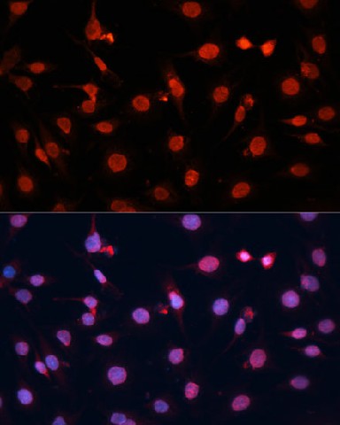 Immunofluorescence analysis of C6 cells using FGF2 Polyclonal Antibody at dilution of  1:100 (40x lens). Blue: DAPI for nuclear staining.