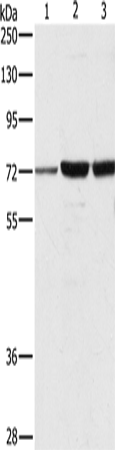 Western Blot analysis of A375, 231 and hela cell using DOK1 Polyclonal Antibody at dilution of 1:750