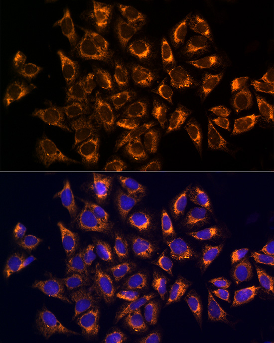 Immunofluorescence analysis of U2OS cells using CKAP4 Polyclonal antibody at dilution of 1:100. Blue: DAPI for nuclear staining.