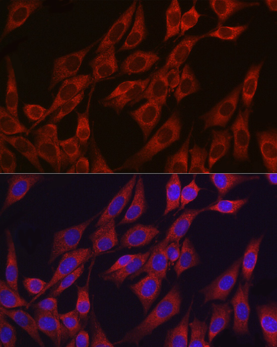 Immunofluorescence analysis of NIH/3T3 using VEGF Polyclonal Antibody at dilution of 1:200 (40x lens). Blue: DAPI for nuclear staining.