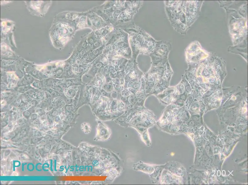 MDA-MB-175VII (DMEM) Cell Complete Medium - 5
