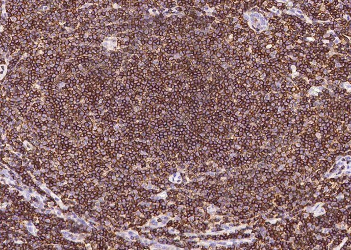 CD45/Ptprc Monoclonal Antibody - 3