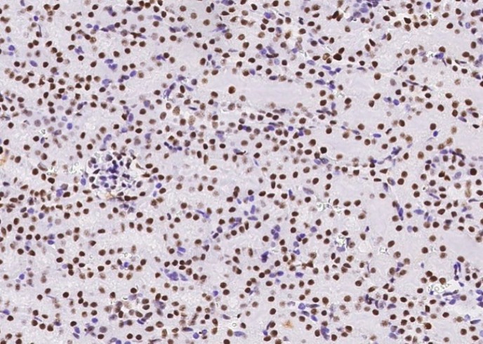 Recombinant MSH6/GTBP Monoclonal Antibody - small - 7