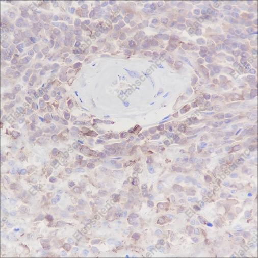 Recombinant ARPC5/p16 ARC Monoclonal Antibody - 2