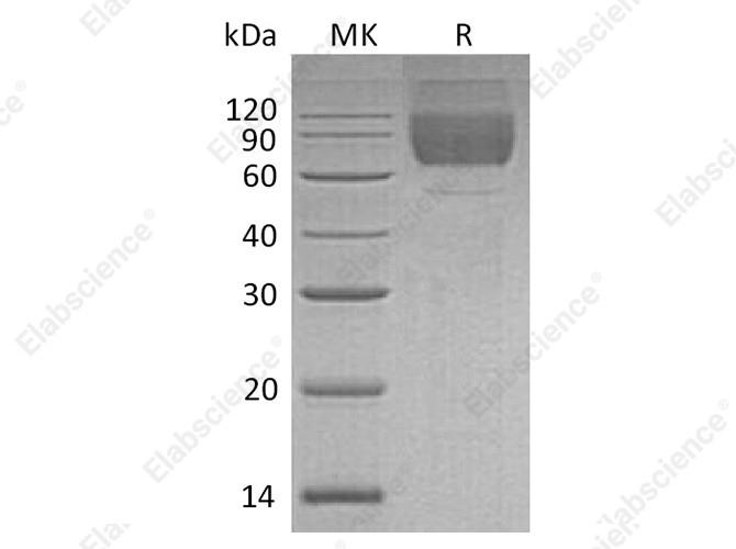 Recombinant Human LIMP-2/LIMPII Protein (His Tag) - 1