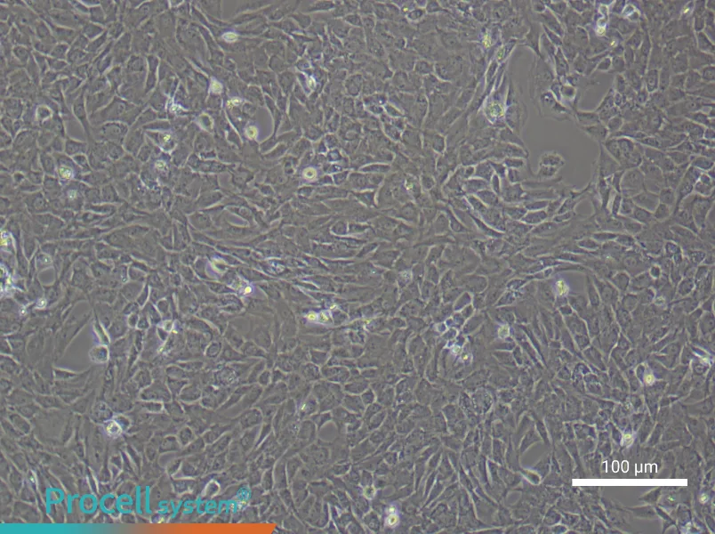 Rat Temporomandibular Joint Chondrocyte Complete MediumRat Temporomandibular Joint Chondrocyte Complete Medium - 2