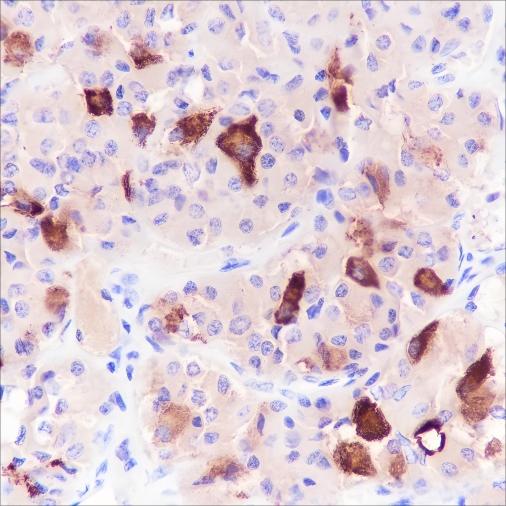 Recombinant FSH beta Monoclonal Antibody - small - 2