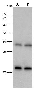 Interferon Gamma Monoclonal Antibody-searchlist-1