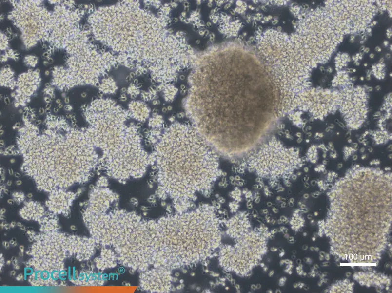 NCI-BL2009 Cell Complete Medium - 1