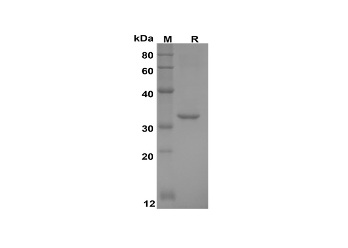 Recombinant Human CXCL9/MIG Protein(Trx Tag)-1