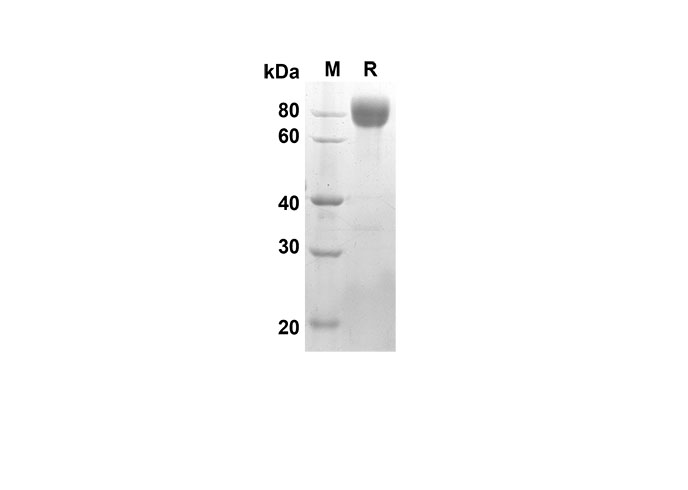 Recombinant Mouse IL-1ra/IL-1F3 Protein(His Tag)-产品推荐-1