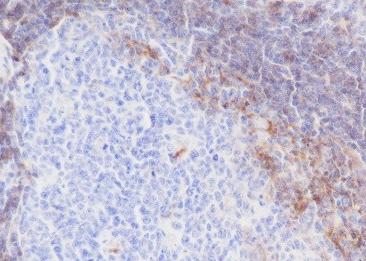 Recombinant CD23 Monoclonal Antibody-searchlist-1