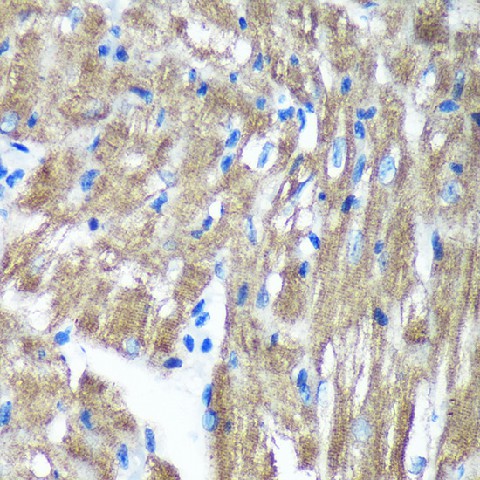 Immunohistochemistry of paraffin-embedded Mouse heart using TIMMDC1 Polyclonal Antibody at dilution of 1:100 (40x lens).Perform microwave antigen retrieval with 10 mM PBS buffer pH 7.2 before commencing with IHC staining protocol.