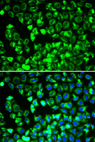 Immunofluorescence analysis of HeLa cells using DLD Polyclonal Antibody
