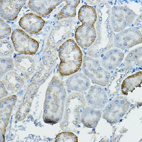 Immunohistochemistry of paraffin-embedded mouse kidney using FAM160B2 Polyclonal Antibody at dilution of 1:100 (40x lens).Perform high pressure antigen retrieval with 10 mM citrate buffer pH 6.0 before commencing with IHC staining protocol.