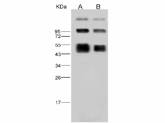 Western Blot analysis of Recombinant DENV (type 2, strain New Guinea C) NS1 Protein (His Tag)(PKSV030124 with 30ng and 10ng) using Anti-Dengue virus DENV-2(Strain New Guinea C) NS1 Polyclonal Antibody at dilution of 1:2000.