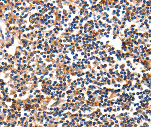 Immunohistochemistry of paraffin-embedded Human tonsil using FADD Polyclonal Antibody at dilution of 1:35