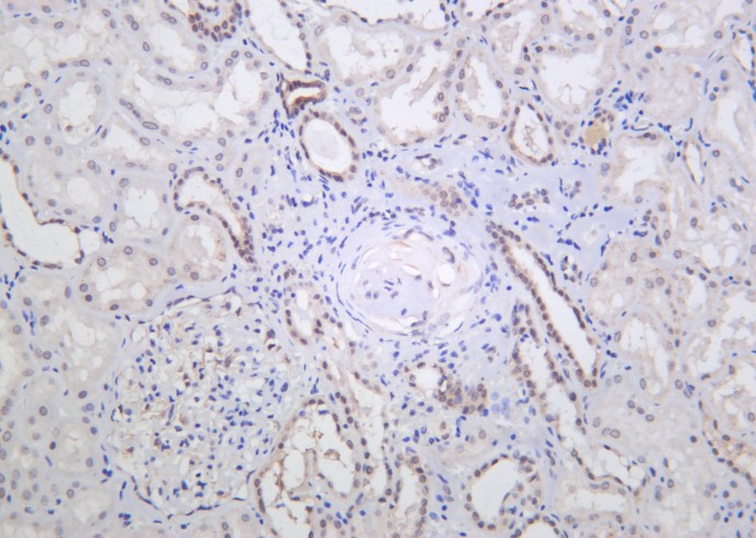 Recombinant Nibrin Monoclonal Antibody - small - 2