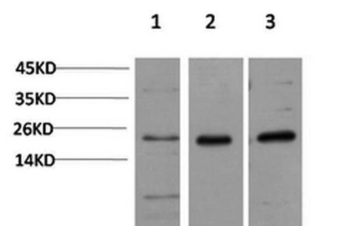 Western Blot analysis of 1) Hela, 2)3T3, 3) PC-12 cells using CBX5 Monoclonal Antibody at dilution of 1:1000.