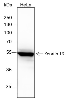 Recombinant Keratin 16 Monoclonal Antibody-searchlist-1