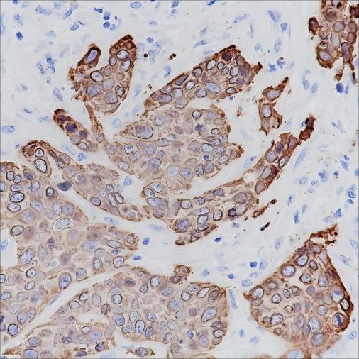 Recombinant Keratin 17 Monoclonal Antibody - 2