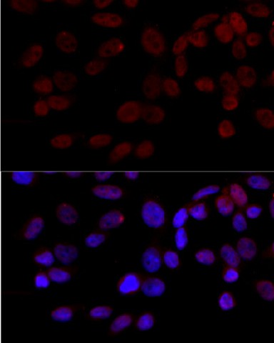 Immunofluorescence analysis of HeLa cells using JNK1 Polyclonal Antibody at dilution of 1:100 (40x lens). Blue: DAPI for nuclear staining.
