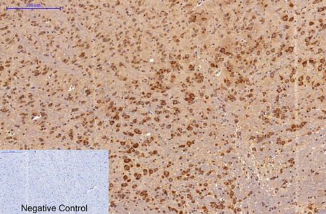 Immunohistochemistry of paraffin-embedded Mouse brain tissue using Survivin Monoclonal Antibody at dilution of 1:200.