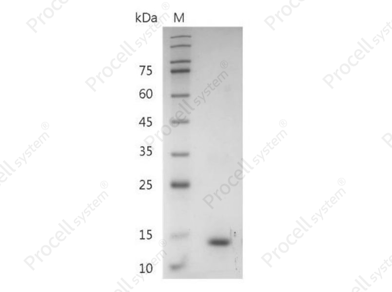 IL-31, Mouse, Recombinant