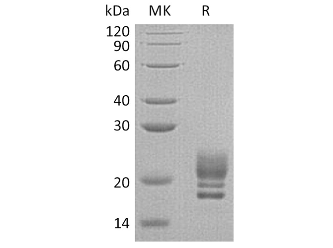 Recombinant Human COQ7 Protein (His Tag)