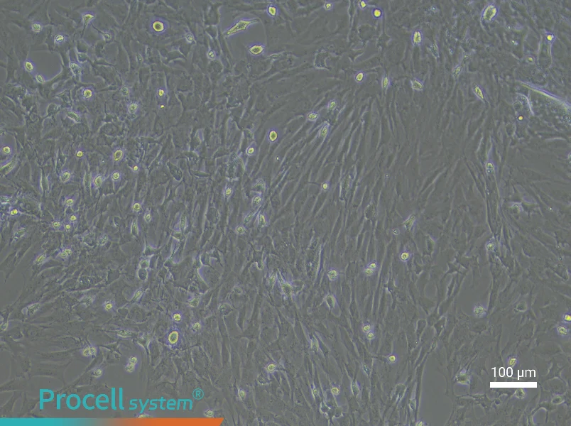 Rat Pancreatic Stellate Cell Complete Medium - 3