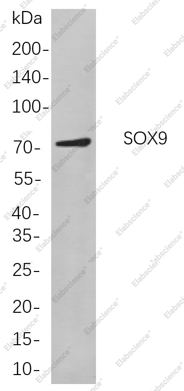 Recombinant SOX9 Monoclonal Antibody - 1