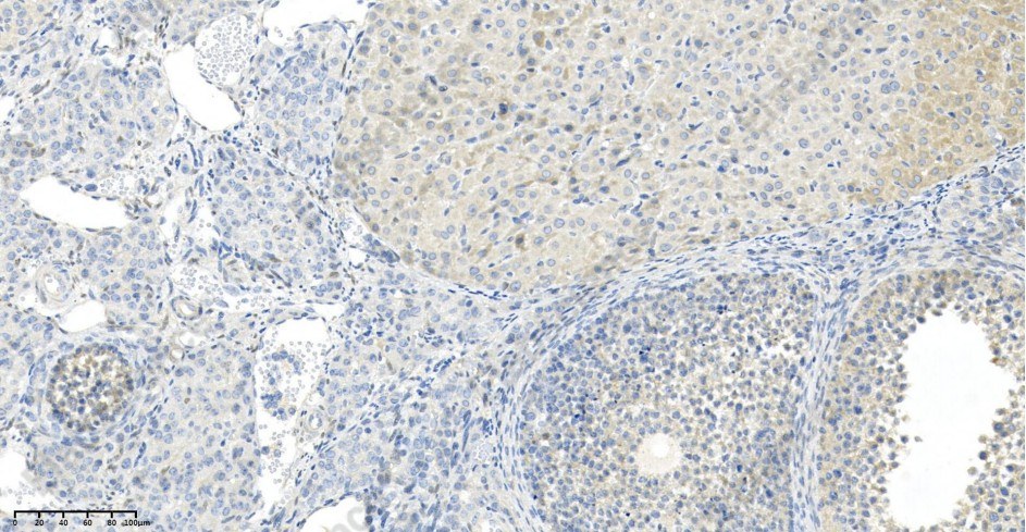 Recombinant Phospho-mTOR (Ser2448) Monoclonal Antibody - 2