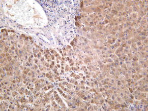 Recombinant METTL16 Monoclonal Antibody - 2