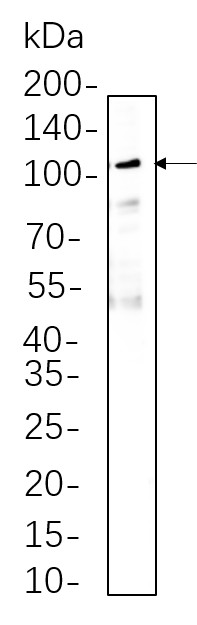 Recombinant MMP9 Monoclonal Antibody-searchlist-1